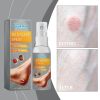 South Moon Skin Care Spray, Full Body Skin Care Moisturizing And Repairing Dry Skin Spray