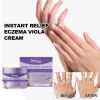Eelhoe Skin Repair Cream Repair Hand And Foot Skin Moss To Relieve Itching And Redness Moisturizing Skin Care Cream