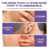 Eelhoe Skin Repair Cream Repair Hand And Foot Skin Moss To Relieve Itching And Redness Moisturizing Skin Care Cream