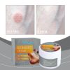 South Moon Skin Care Cream, Herbal Ingredients Gentle Formula Skin Repair Skin Moisturizing Care Cream