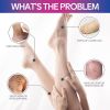 Ximonth Leg Care Cream Moisturizing Massage Treatment Cream For Leg Extension Repair Skin