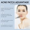 OUHOE Acne Patch Mild Clear Acne, Close Repair Skin Facial Care Invisible Acne Patch